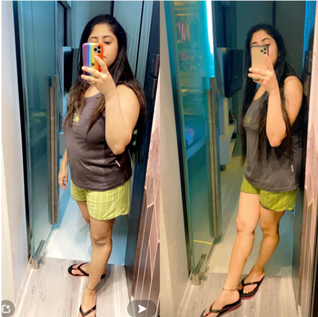 Binny Wadhwa before and after